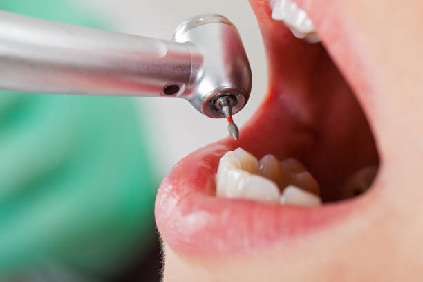 Best Emergency Care for Gum Disease in Rural Retreat, VA